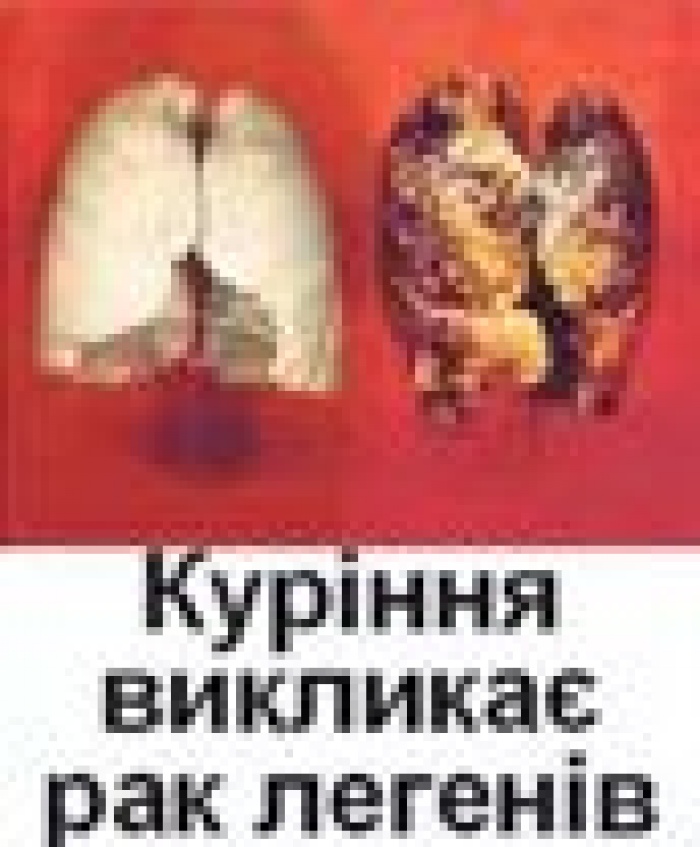 Кабмин утвердил перечень картинок, которыми будут пугать курильщиков